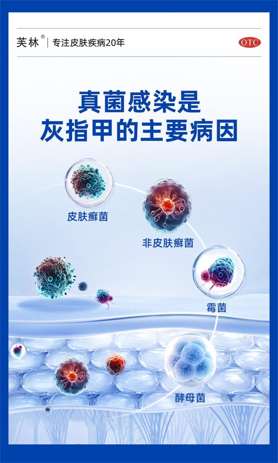 【中國直郵】 芙林 鹽酸阿莫羅芬搽劑 阿莫羅芬擦劑治灰指甲 強滲透 殺菌抑菌 1ml/盒