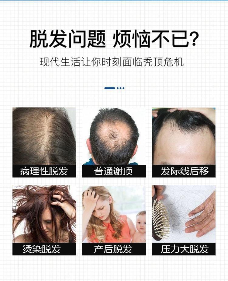【中国直邮】 修正 防脱育发洗发液生姜侧柏叶生增发密发固发苗坚洗发水控油蓬松 防脱育发洗发水300ml