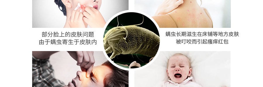 日本UYEKI 防螨虫除菌喷雾剂 孕妇婴儿可用 无香型 250ml 过敏痘痘克星 有效作用1个月【过敏痘痘克星】