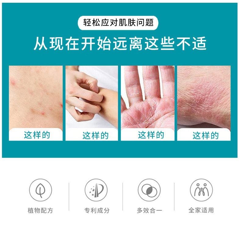 中国 严和 脚气偏方软膏20g/盒 皮肤外用深层修复 抑菌 止痒