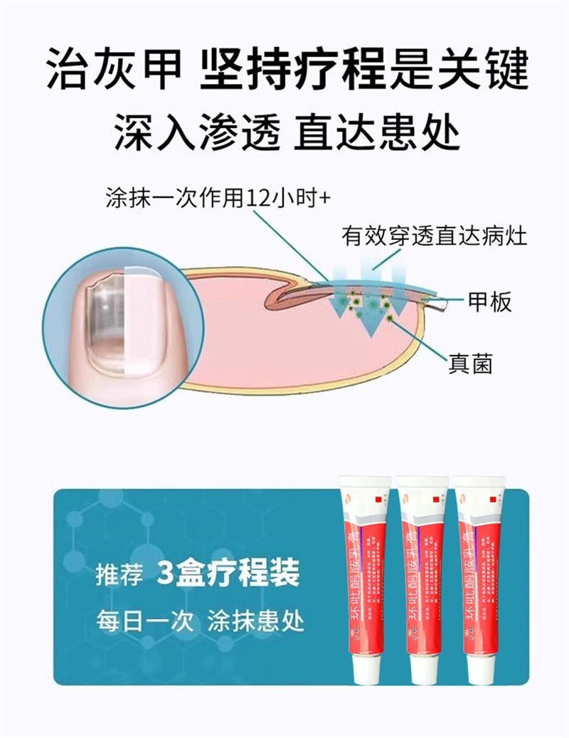  仁和 环吡酮胺乳膏10g灰指甲治疗专用药膏水正品真菌感染脚气药