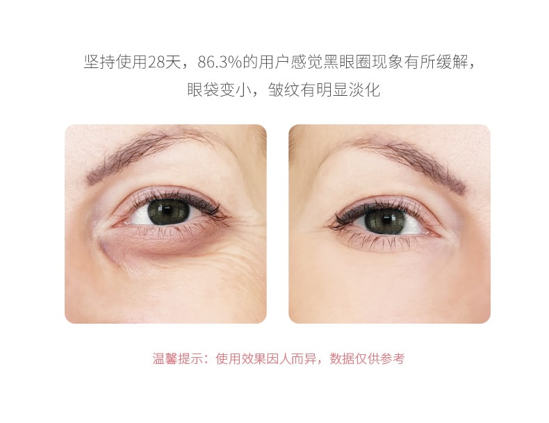 [中国直邮]眼部按摩仪射频抗皱美容仪去眼袋细纹黑眼圈美眼神器眼霜导入