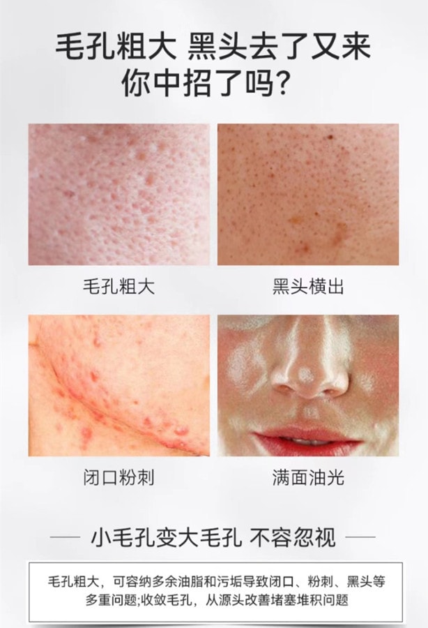 【中國直郵】Renhe 仁和匠心淨透毛孔收縮精華液100ml 1瓶裝 毛孔粗大補水保濕精華液收斂縮小 國貨之光