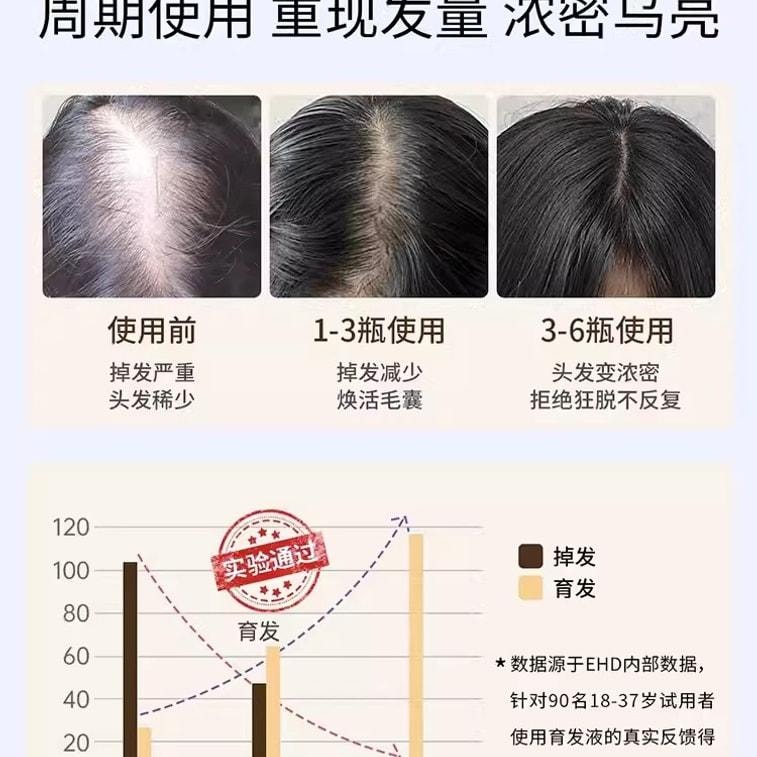 【中國直郵】 EHD 防脫護髮精華液強韌健發滋養柔順髮際線男女蓬鬆 60ml瓶