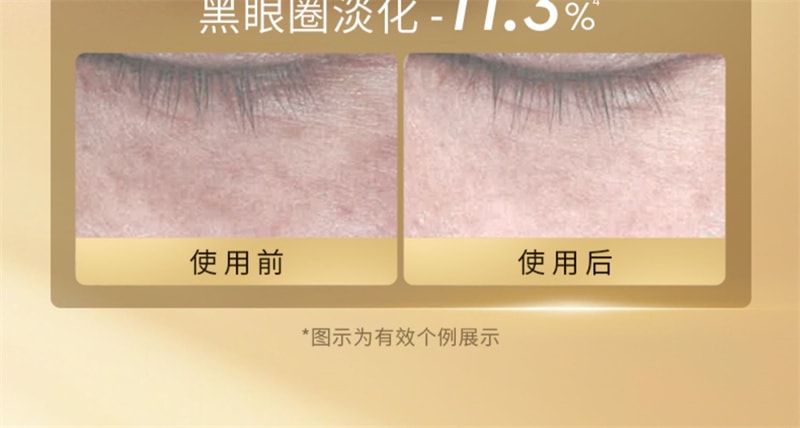 【中國直郵】澳洲 cemoy. 第3代小飛碟 晶耀立體緊緻多效眼霜 撫眼紋 提眼角 淡淚溝 塑眼廓 20ml/瓶【朱梓驍同款】