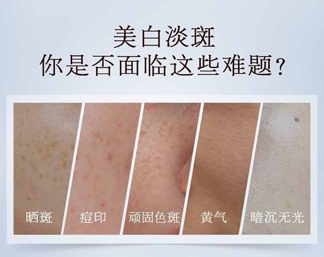 【日本直郵】資生堂ELIXIR怡麗絲爾 全新雙效淨白煥顏美白精華液22g@COSME大賞