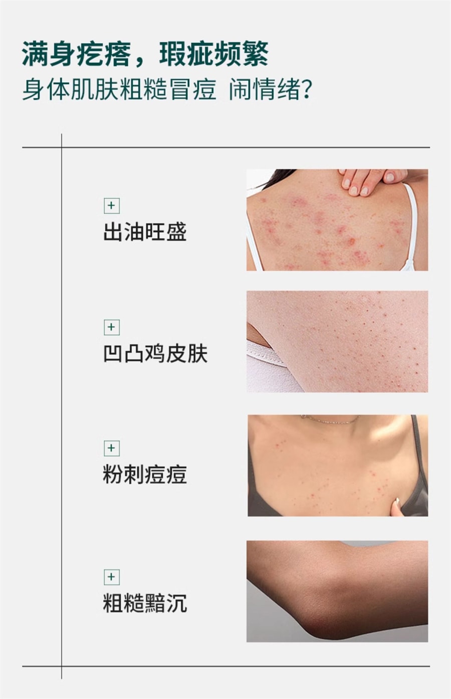 【中国直邮】梵可清 复合酸身体净肤精华乳 祛痘背部黑头痘痘 50g/支 (七老板推荐)