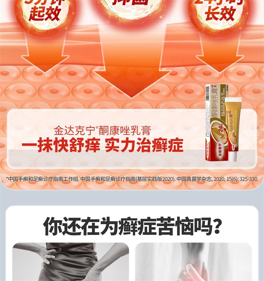  达克宁 酮康唑乳膏股癣专用药汗斑花斑癣药膏体癣手足癣花斑止痒 15g /支