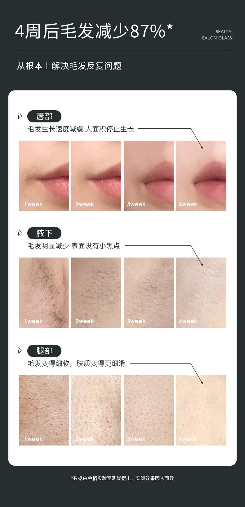 金稻 蓝宝石 冰点激光脱毛仪 脱毛 腋下脱毛 全身可用 美容院家用脱毛仪 KD506A 1台