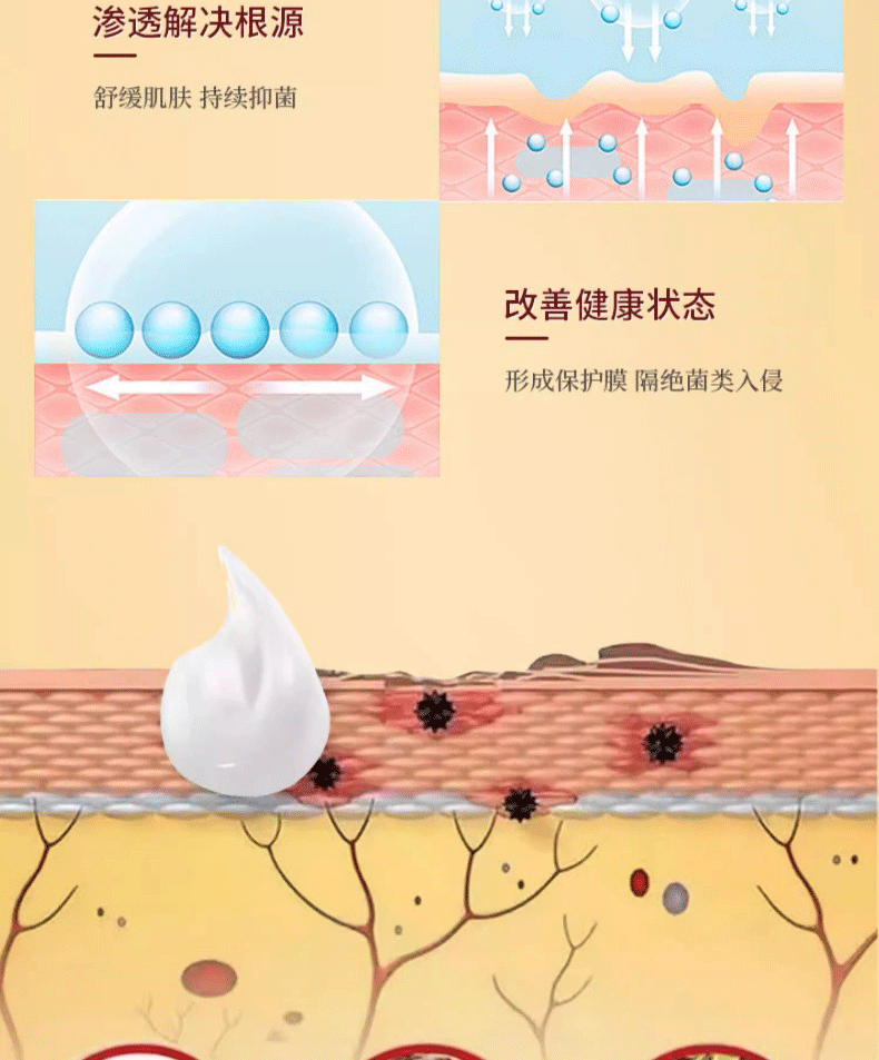 【中国直邮】 祥医堂 断痒王 止痒膏皮肤痒断痒膏 一抹止痒 草本秘制 安全健康 30g/盒
