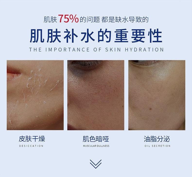 素秀臣氏 果酸VE尿素膏【改善鸡皮肤】全身美白 补水保湿滋润 维生素E乳膏 20g