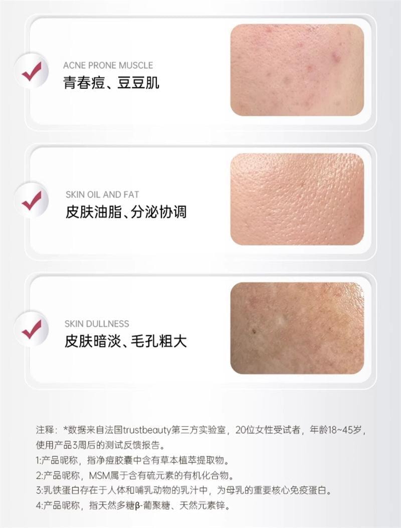 【中国直邮】 碧维斯 净痘胶囊 男女控油净痘粉刺淡化痘印收缩毛孔 60粒/盒