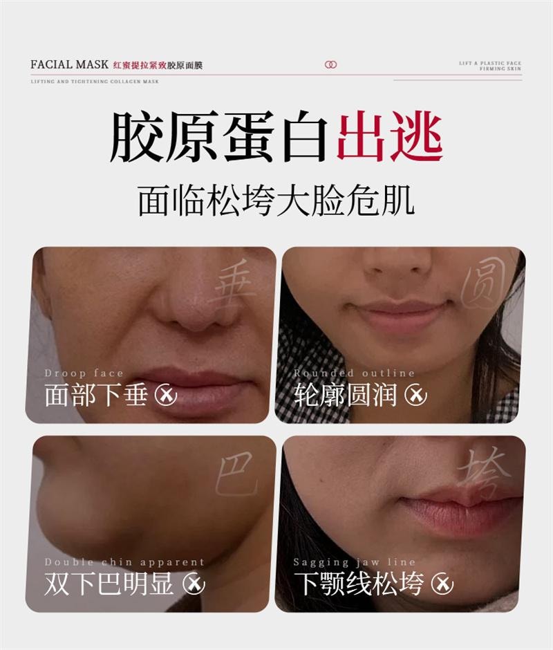 韩伦美羽 红蜜提拉紧致胶原面膜 脸部挂耳式贴片双下巴V脸瘦脸神器 5片/盒