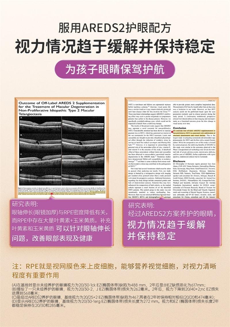 【中国直邮】 澳大利亚 优思益 儿童护眼咀嚼片 叶黄素片 青少年学生近视护眼 60粒/盒
