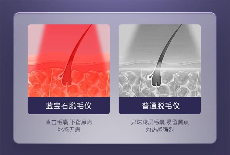 【中國直郵】 歐橘 藍寶石冰點除毛儀器家用雷射男女士專用密處非永久唇毛學生黨 air4水晶紫1台