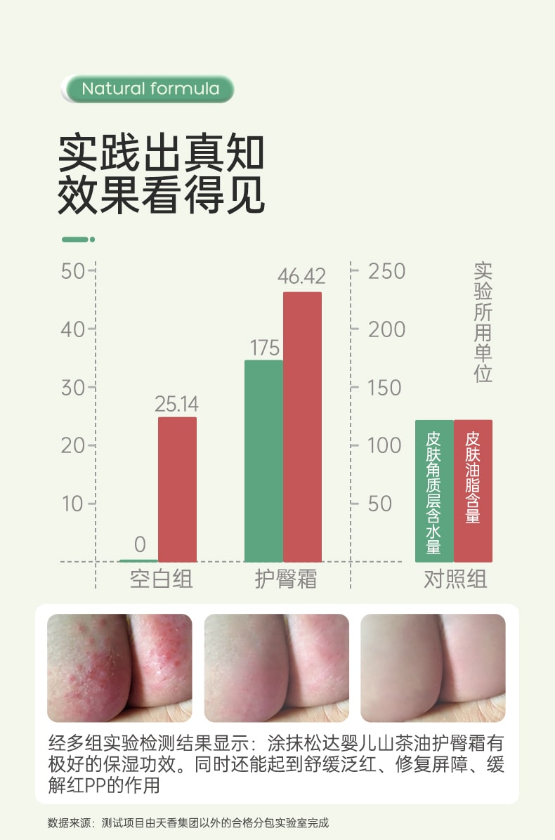 【中國直郵】鬆達 嬰兒 紅屁屁 山茶油護臀膏 21g