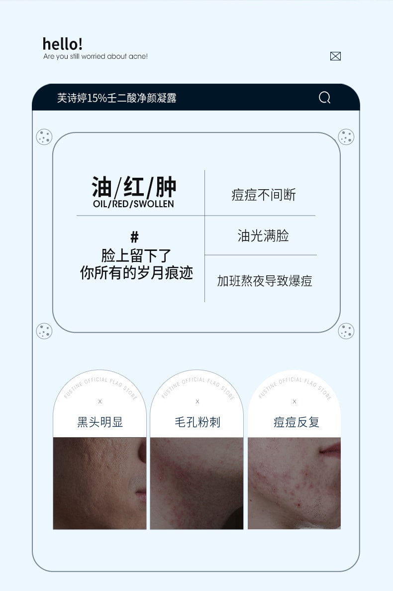 【中國直郵】芙詩婷 15%壬二酸凝露凝膠 祛痘膏 去黑鼻頭15g