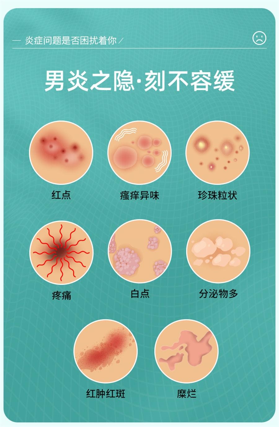 【中國直郵】 硬核醫師 曲咪新乳膏 治包皮龜頭炎 抗菌消炎止癢18g/盒