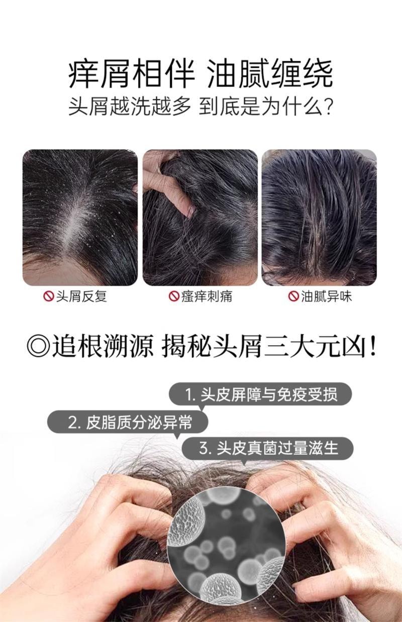 【中国直邮】 康王 去屑洗发水 二硫化硒洗发液 止痒控油蓬松头皮清洁洗发露洗头膏 460ml/瓶(清爽净澈型)