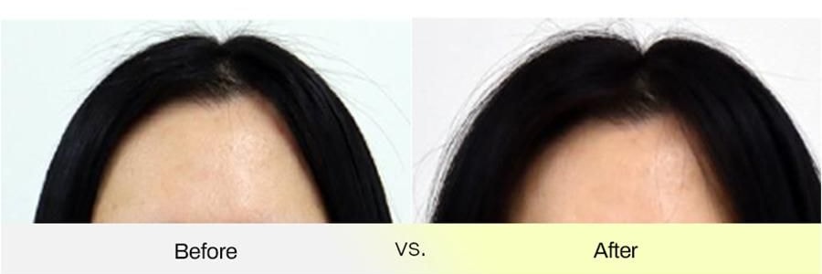 韩国GRABITY 防脱固发洗发水 加强型 475ml​​ 缓解脱发 极细发质/短发专研