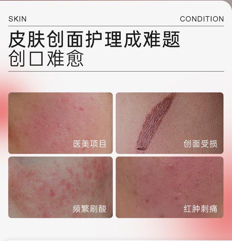 哈三联 医用透明质酸钠修复贴(白膜)5片装 保湿修润 创面修复 构建屏障