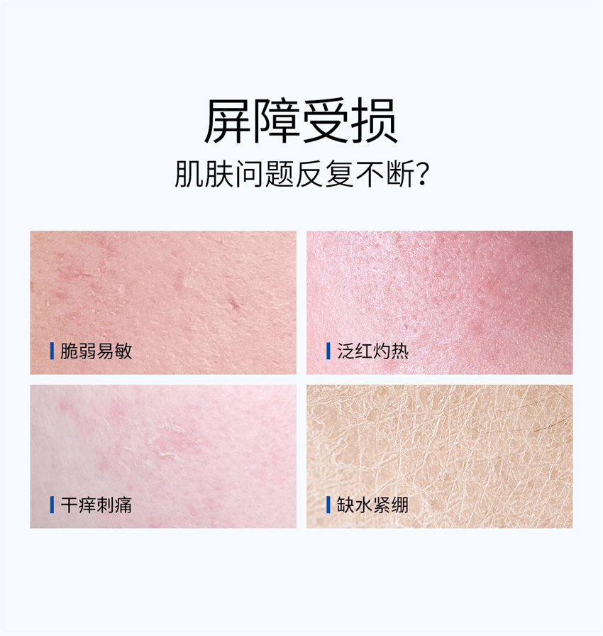 【中國直郵】 ddg 維生素B5煥活保濕修護精華 補水保濕維穩修護 30g/瓶【滋潤版】