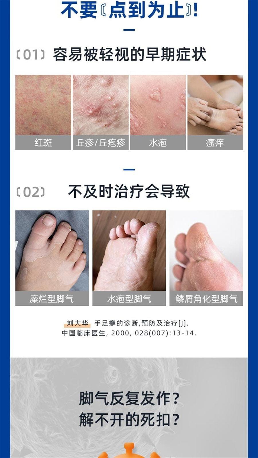 Terbinafine Hydrochloric Acid Gel Fungal Infection Treatment Of Jock Itch To Beriberi Ointment Foot Odor Peeling 20g