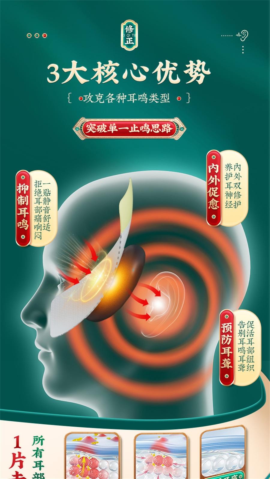 【中国直邮】 修正 穴位磁疗贴 耳鸣贴耳聋痛痒肿神经性耳鸣耳朵嗡嗡响王克星中耳炎专用贴膏12贴/盒
