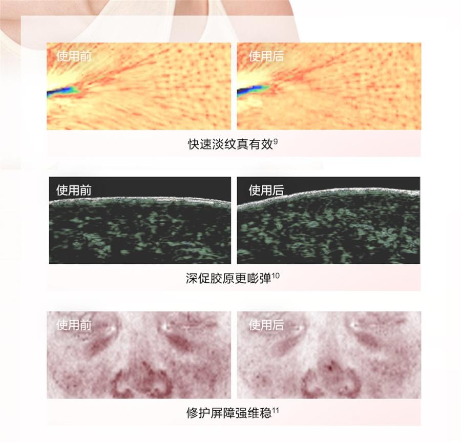 【中国直邮】 韩束 红蛮腰次抛 闪充棒环肽次抛紧致抗皱淡纹精华 30支/盒