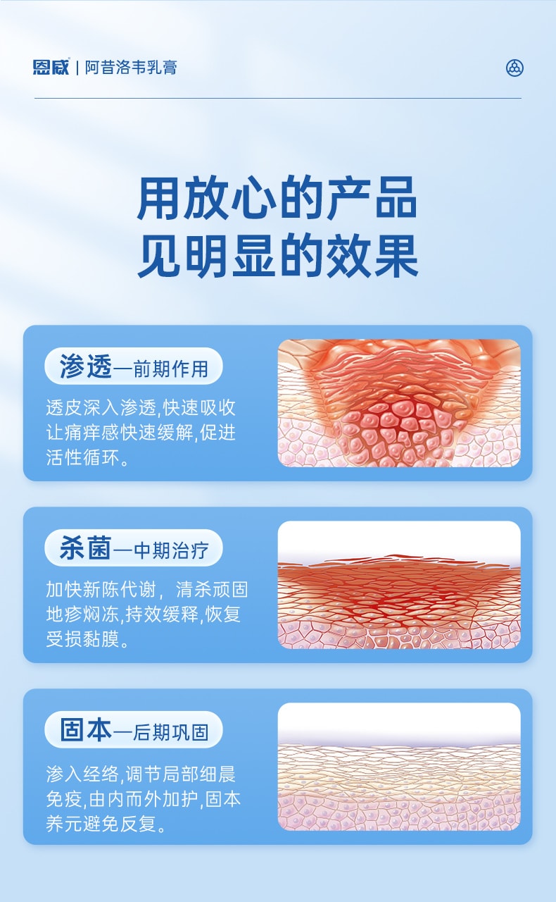 【中国直邮】 恩威 阿昔洛韦软膏 正品抗病毒阿西洛韦阿希洛韦带状单纯疱疹药膏 20g/盒