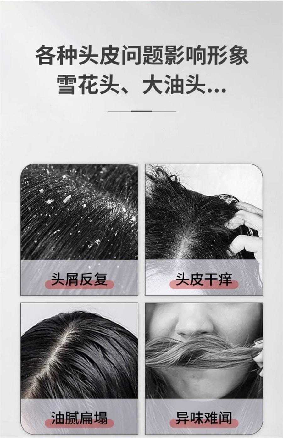 【中国直邮】 广药白云山 二硫化硒洗发水 去头屑清洁控油蓬松止痒护发洗发露400ml/瓶
