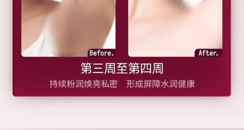 中國 TZK 婷資可私處護理凝膠粉嫩去黑色素嫩紅精華素 1件