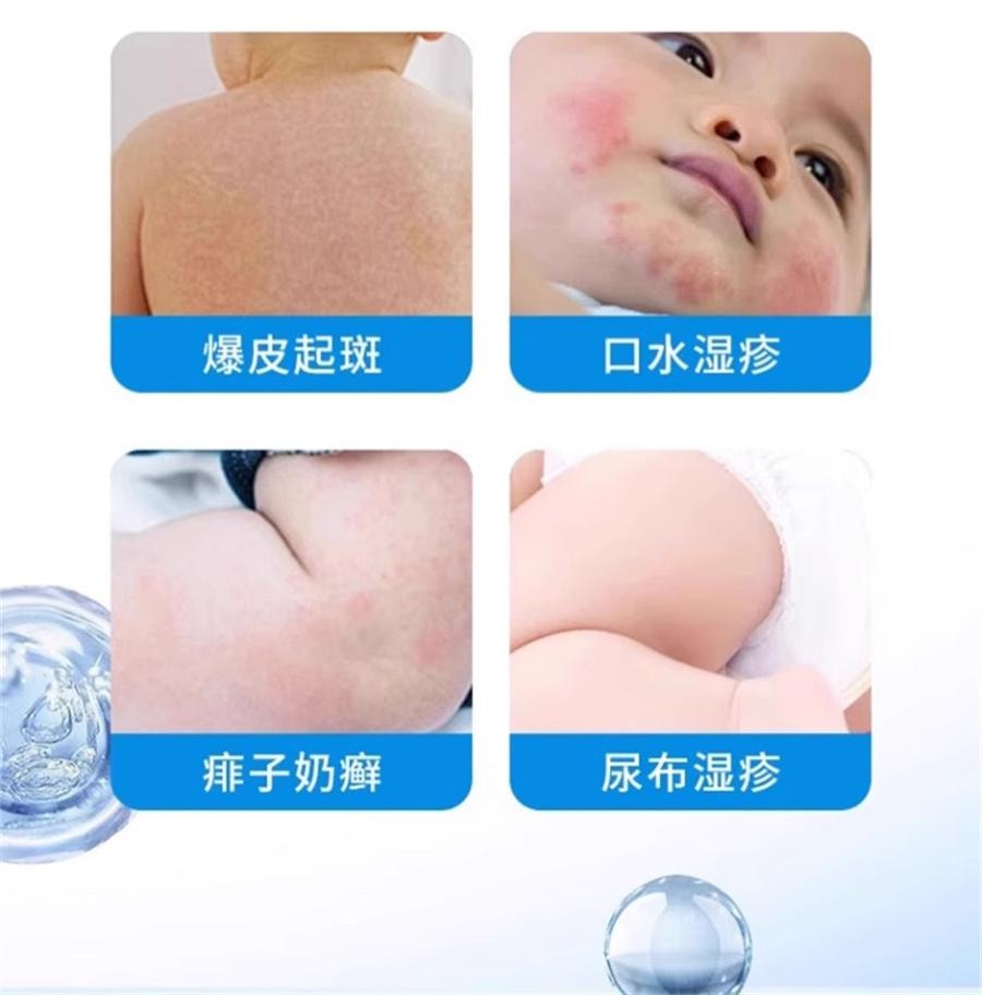 【中国直邮】 云南本草 炉甘石舒缓膏 湿热红疹洗液剂婴儿专用止痒去宝宝倍护舒缓膏30g/支