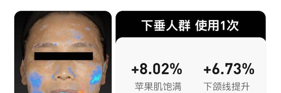FLOSSOM花至 面部肌提美容仪器 家用脸部提拉紧致超膜刀Skinpilot (头箍肌提美容仪*1+面部美容装*8) 【旺旺同款】