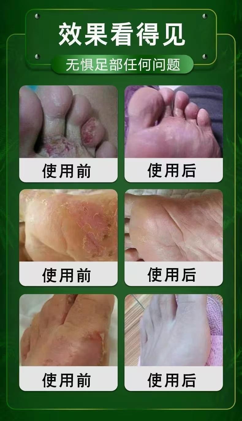 Foot Odor And Sweat Spray 50 ml