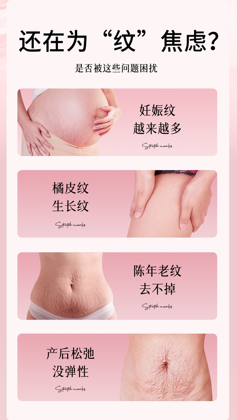 【中國直郵】 修正 醫用矽酮疤痕凝膠 去妊娠紋產後消除疤痕膏 修復肥胖紋淡化緊緻肚皮修復霜除疤膏 15g/支