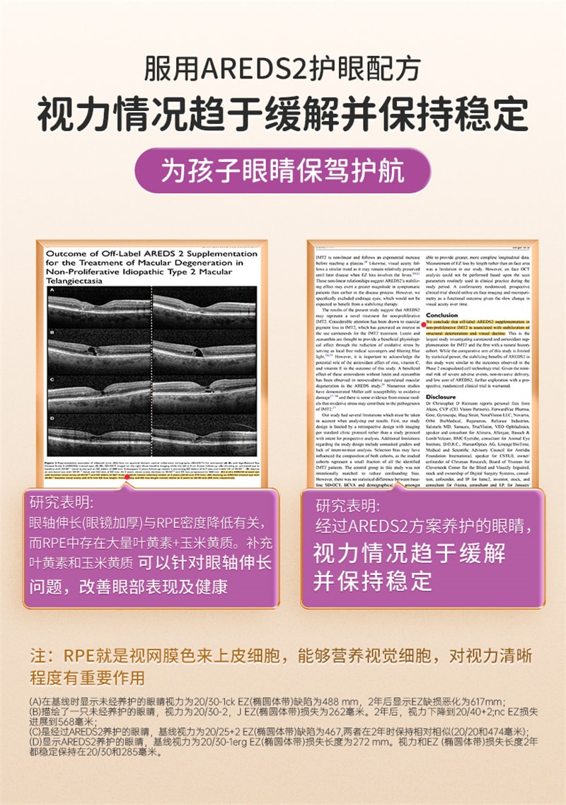 【中国直邮】Youthit优思益 儿童叶黄素60粒/盒 青少年学生近视护眼