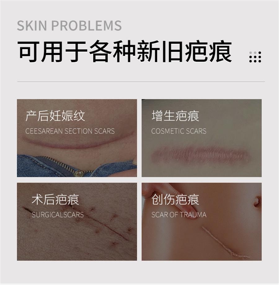 【中国直邮】 思恩 医用硅酮凝胶原蛋白护理疤痕修复膏烫伤手术增生剖腹疤痕   20g/支