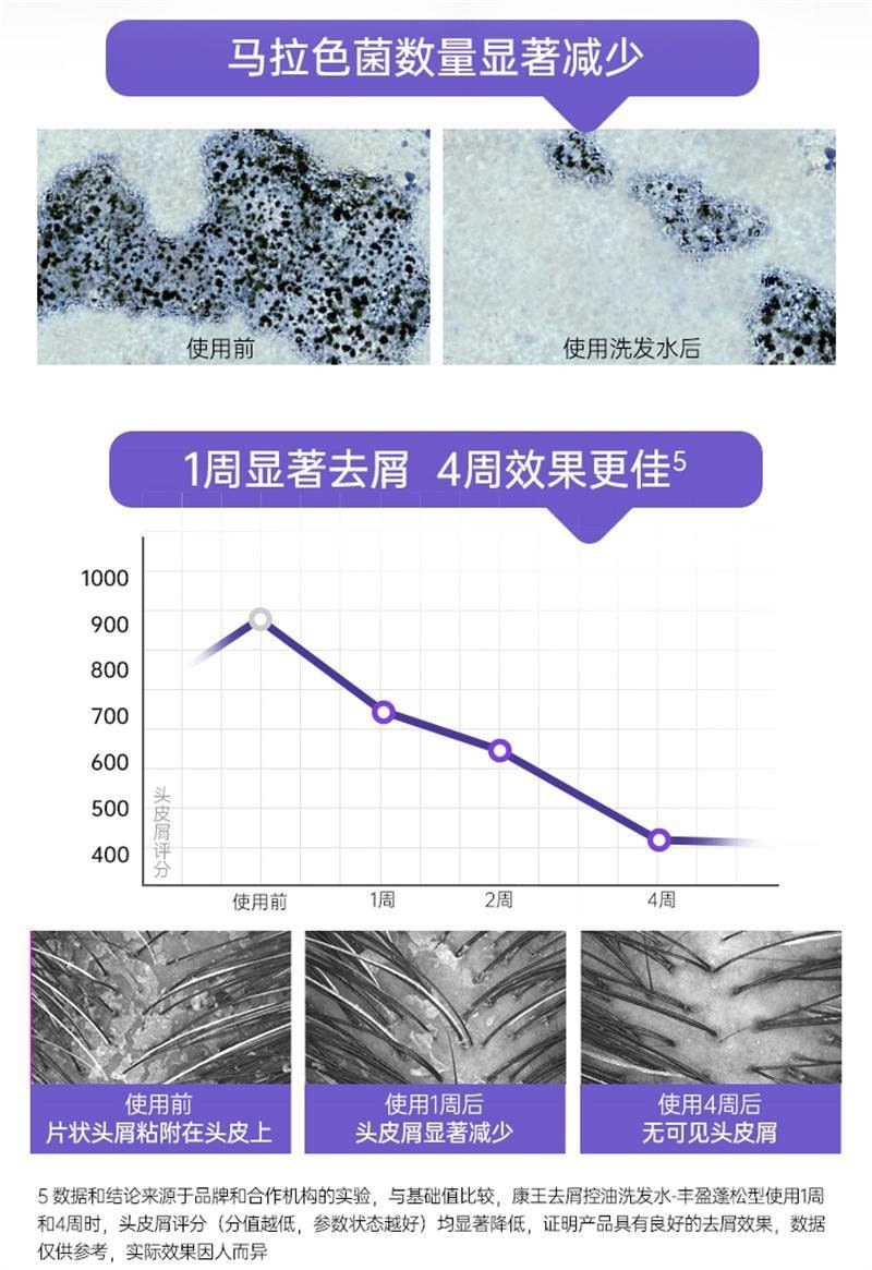 【中国直邮】 康王 去屑洗发水 二硫化硒洗发液 止痒控油蓬松头皮清洁洗发露洗头膏 460ml/瓶(清爽净澈型)