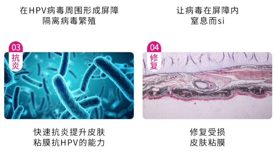 【中国直邮】法兰度 妇科凝胶3g*5支抗hpv生物敷料蛋白重组人干扰素宫颈抑菌