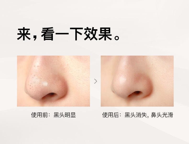 【中国直邮】 RNW/如薇 鼻贴去黑头导出液收缩毛孔深层清洁温和男女通用学生 五组/盒