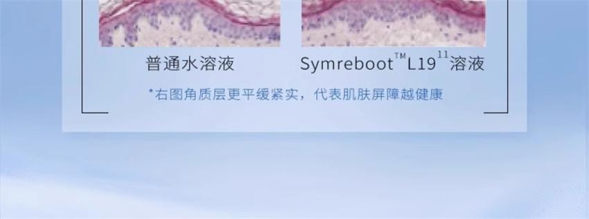 【中國直郵】 韓國 AHC 修紅瓶水乳套裝 敏感肌乾皮水潤護膚維穩保濕修護【115ml水+100ml乳液】