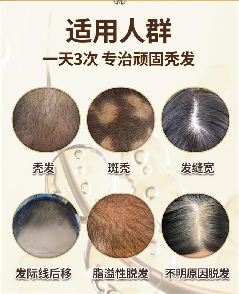 【中国直邮】 斯亚旦 复方生发酊防脱发脂溢性脱发白发斑秃育发生发密发增发 36ml