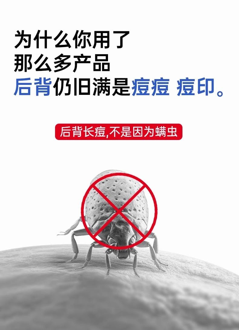 【中国直邮】 丽芙 外用溶液 用于毛囊炎前胸后背祛痘喷雾背部祛痘除螨 30ml/盒