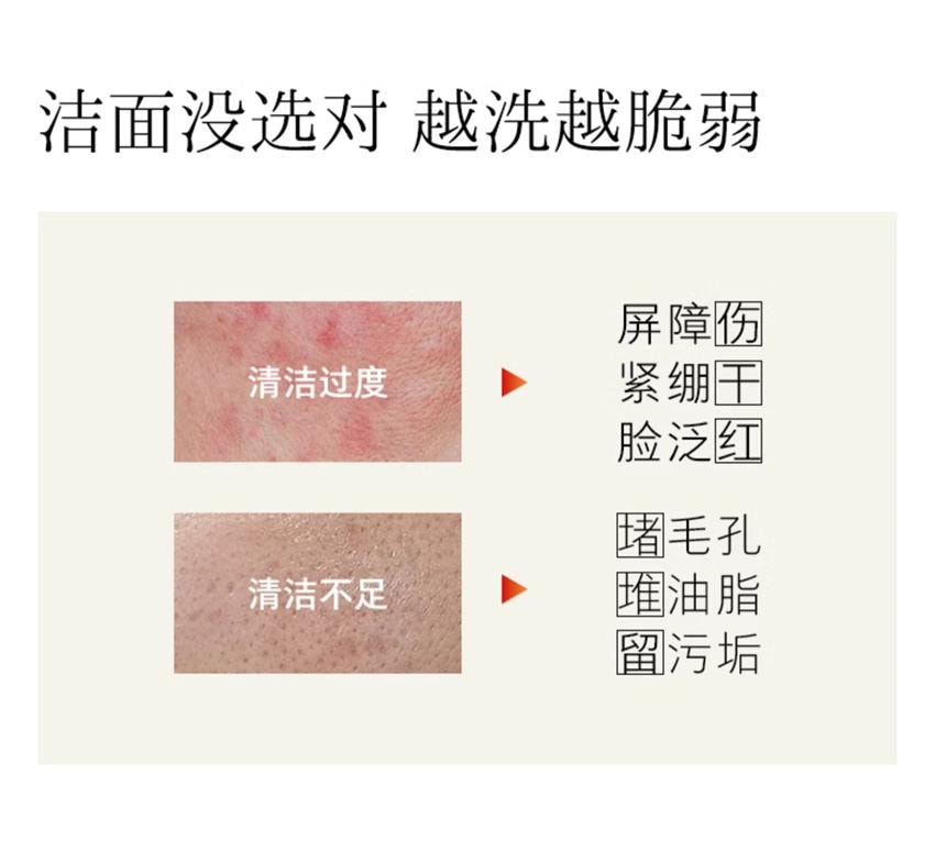 【中国直邮】 hfp 氨基酸平衡净润洁面乳 3重氨基酸 敏肌安选 深层清洁毛孔专用洗面奶 120g/支