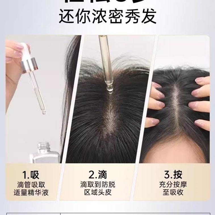 【中國直郵】 康王 腺苷防脫髮小銀瓶防脫固髮賦活頭皮精華液 75ml