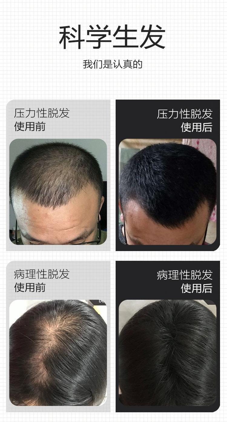 【中国直邮】 修正 防脱育发洗发液生姜侧柏叶生增发密发固发苗坚洗发水控油蓬松 防脱育发洗发水300ml