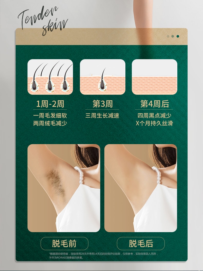 中国 RORA红光波冰点脱毛仪PRO医用嫩肤家用全身腋下刮毛剃毛女士专用 绿色 1件