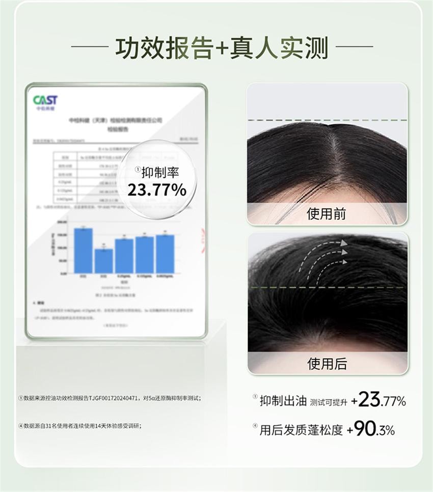 【中国直邮】 舒蕾 莹亮修护洗发水 保湿滋润头皮 修护受损发质洗发露 400g/瓶(张若昀-同款绿金瓶)