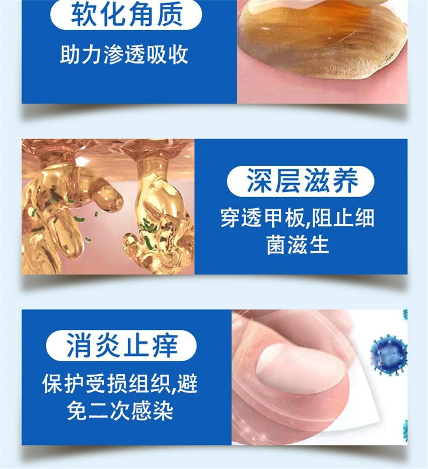 【中国直邮】 祥医堂 阿莫灰甲抑菌擦剂 修复灰指甲脱甲液 阿莫罗芬搽剂灰指甲正品 5ml/盒